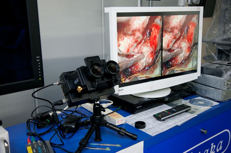 عملية جراحة المخ.