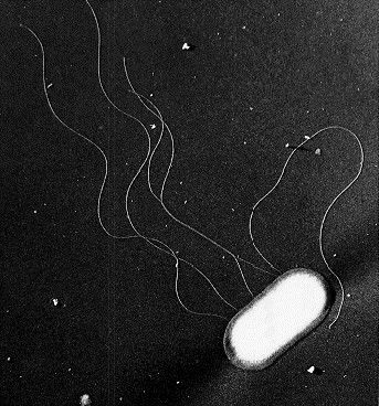 O157（肠出血性大肠杆菌）的电子显微镜照片