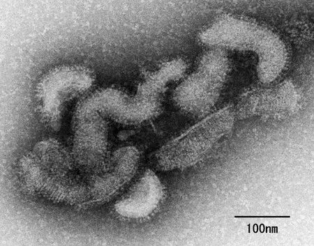 电子显微镜下的Oz病毒（国立传染病研究所提供）