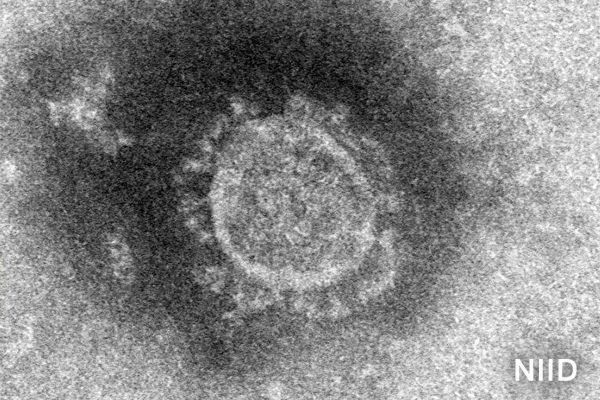 Japan Confirms Record 2,684 New Coronavirus Cases