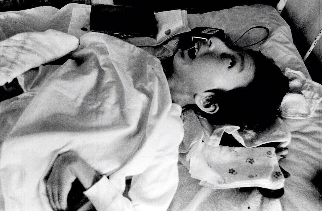 Tomoko: Nació el 13 de junio de 1956. Fue declarada paciente congénita de Minamata en noviembre de 1962 (imagen de 1972, cuando tenía 17 años). 