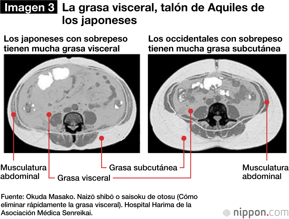 Sección transversal del abdomen, con el ombligo arriba y la espalda abajo.