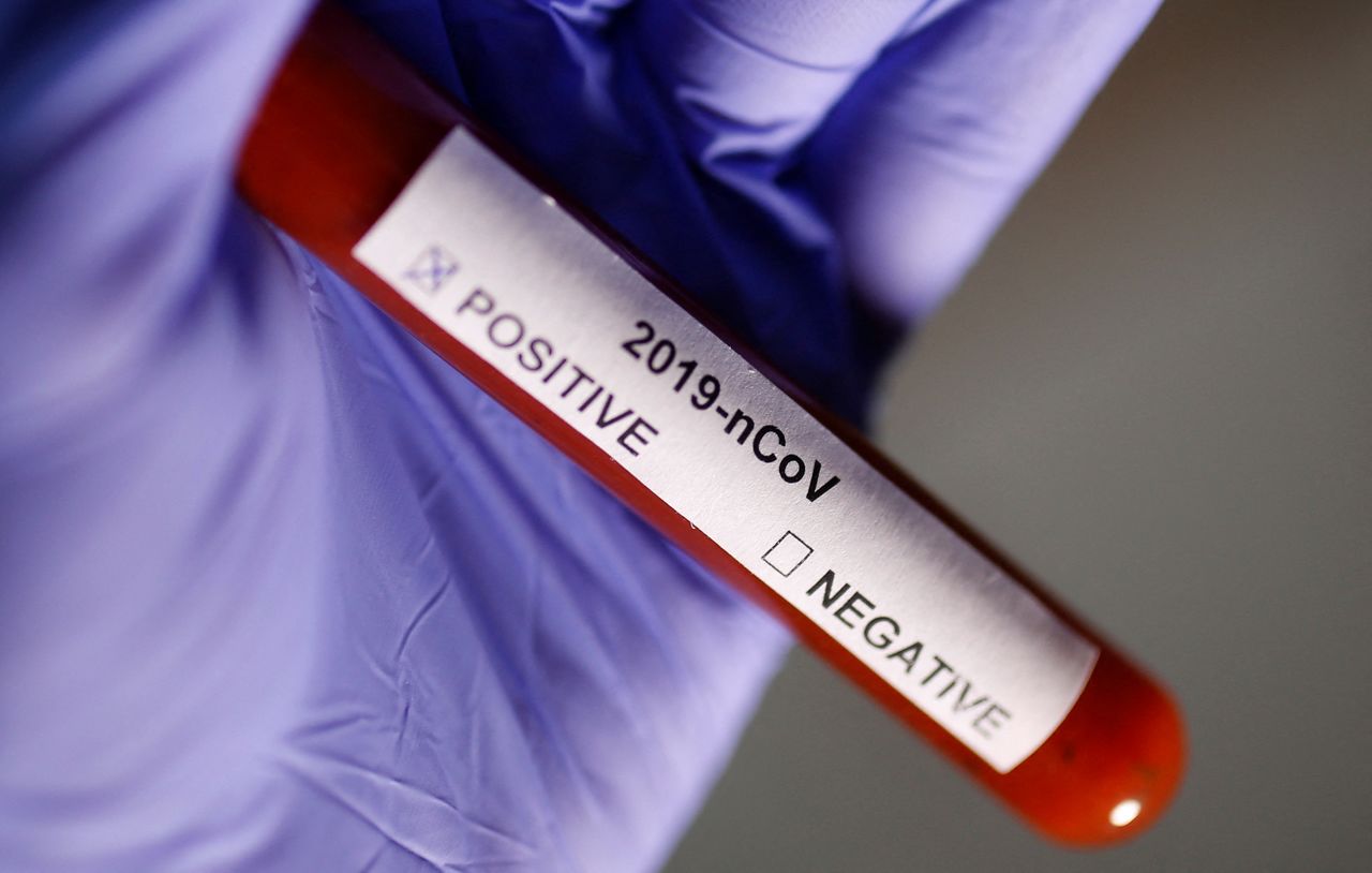 FOTO DE ARCHIVO: Tubo de ensayo con la etiqueta del coronavirus en esta ilustración tomada el 29 de enero de 2020. REUTERS/Dado Ruvic