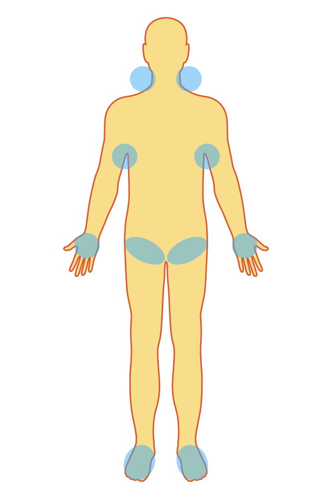 Zones du corps à refroidir en cas de possible coup de chaleur (© Nippon.com)