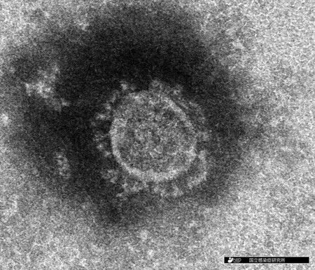 Le coronavirus venu de Chine, vu au microscope électronique (photo avec l'aimable autorisation de l'Institut national de recherche des maladies infectieuses au Japon)