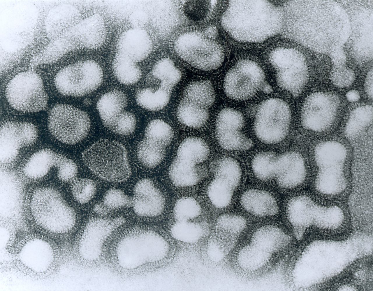 A型インフルエンザウイルスの電子顕微鏡写真（Photo by Smith Collection/Gado/Getty Images）.