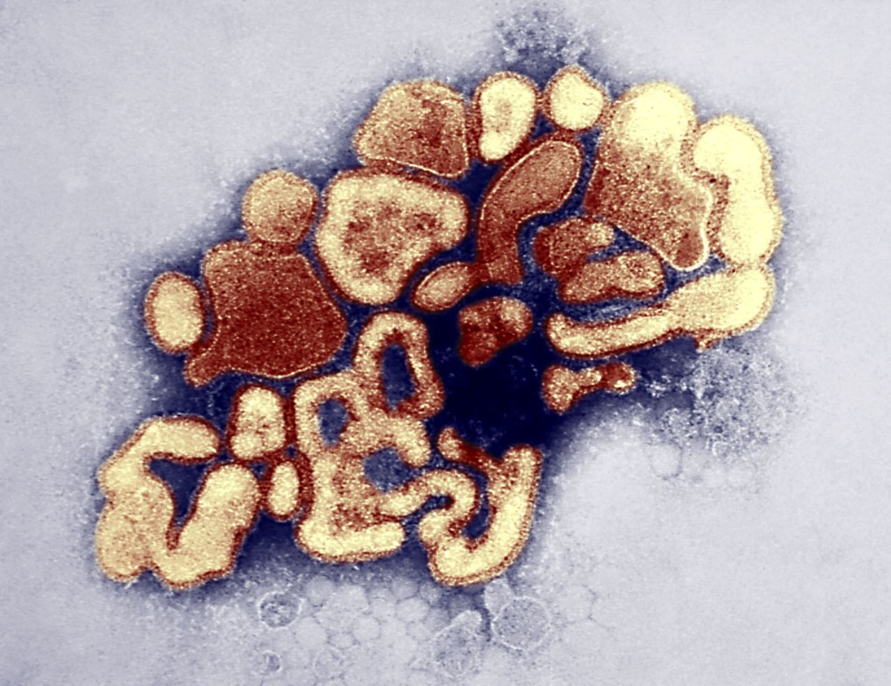 豚インフルウイルスの透過型電子顕微鏡写真（Photo By BSIP/UIG Via Getty Images）