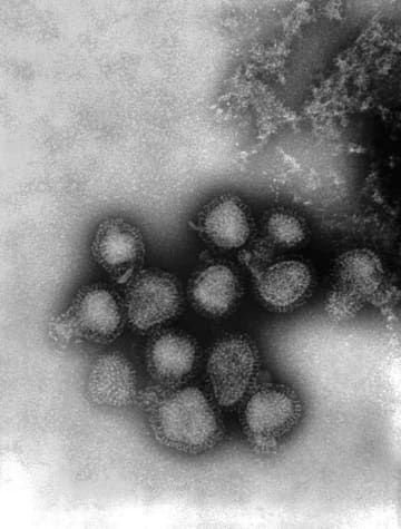 A香港型インフルエンザウイルスの電子顕微鏡写真（米疾病対策センター提供）