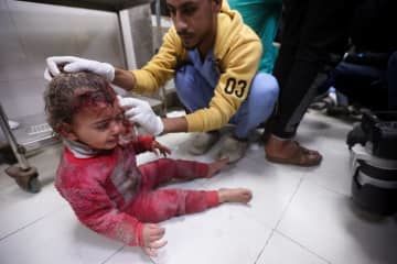 イスラエル軍の攻撃で負傷し、ガザ地区南部ハンユニスのナセル病院で治療を受ける子ども＝12日（ロイター＝共同）