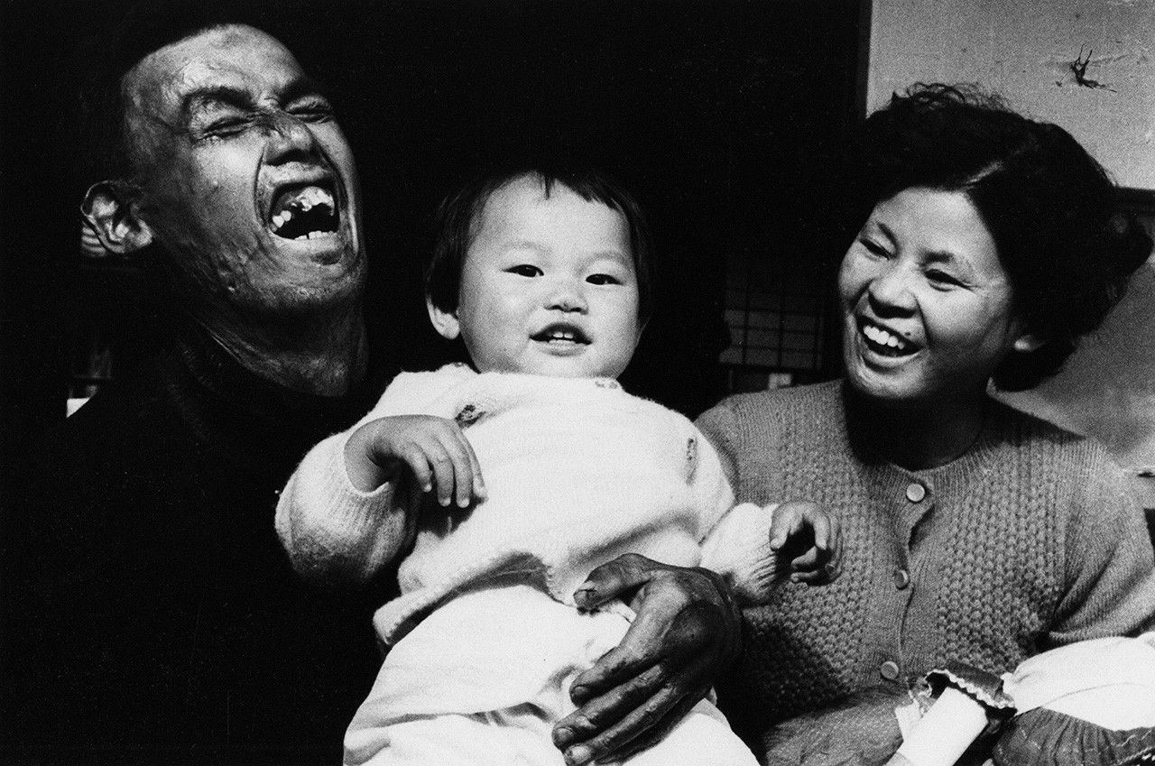 Семья, переживших атомную бомбардировку, 1957 г. Домон Кэн, из альбома «Хиросима», 1958 г. (коллекция Музея фотографии Домона Кэна)